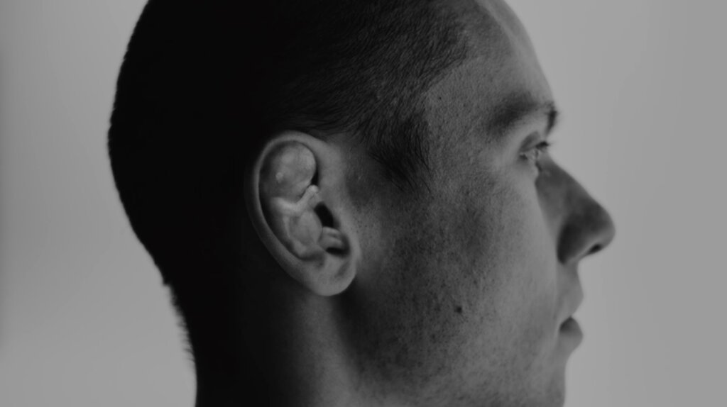 Cauliflower video preview