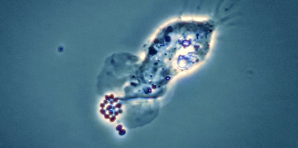 Gustave Roussy Lucie video preview